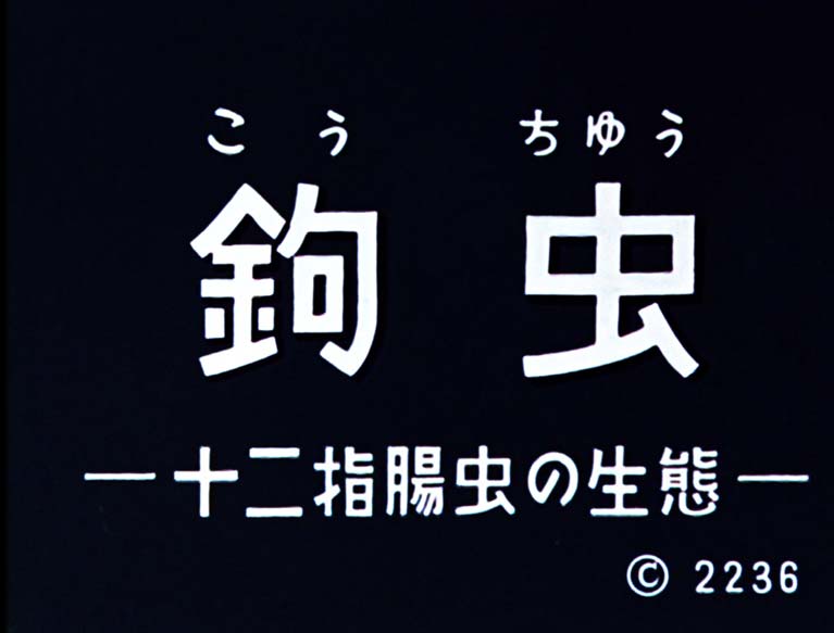 鉤虫 十二指腸虫の生態
