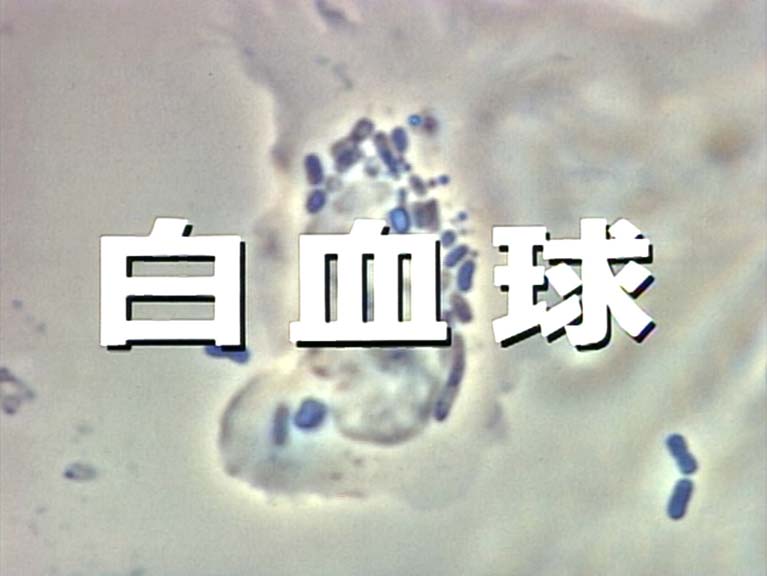 白血球 その増殖・活性化因子G−CSFを求めて