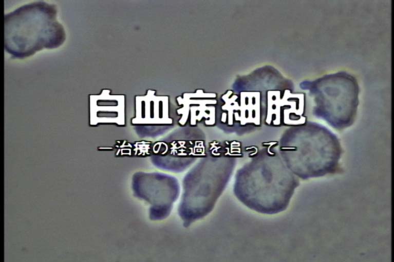 白血病細胞 治療の経過を追って