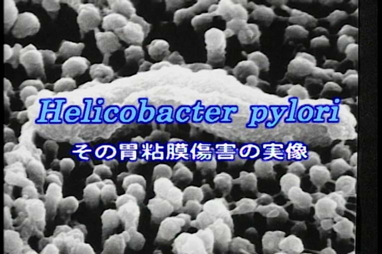 Helicobacter pylori その胃粘膜傷害の実像