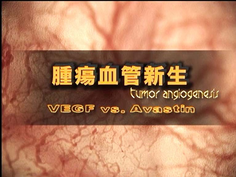 腫瘍血管新生 VEGF vs Avastin